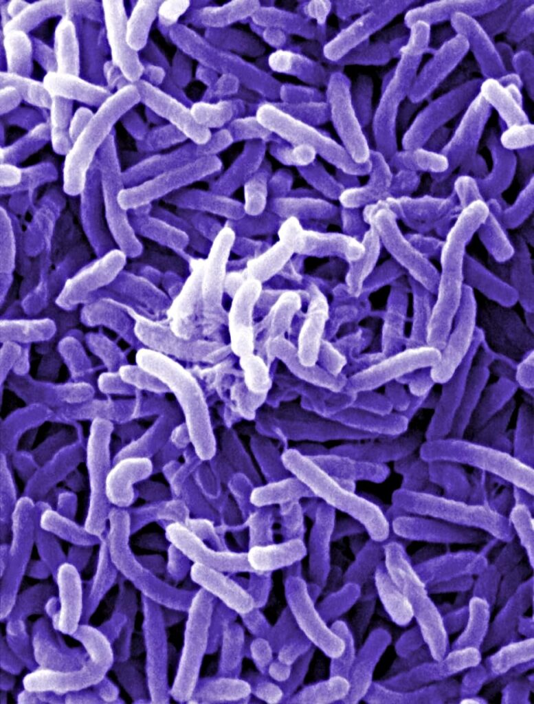 Virus Image: Electron microscope image of Vibrio cholerae bacteria, which causes cholera