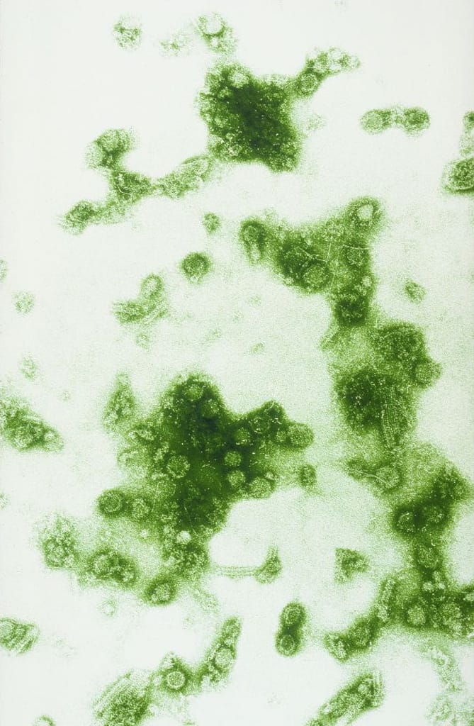 Dengue virus seen under an electron microscope