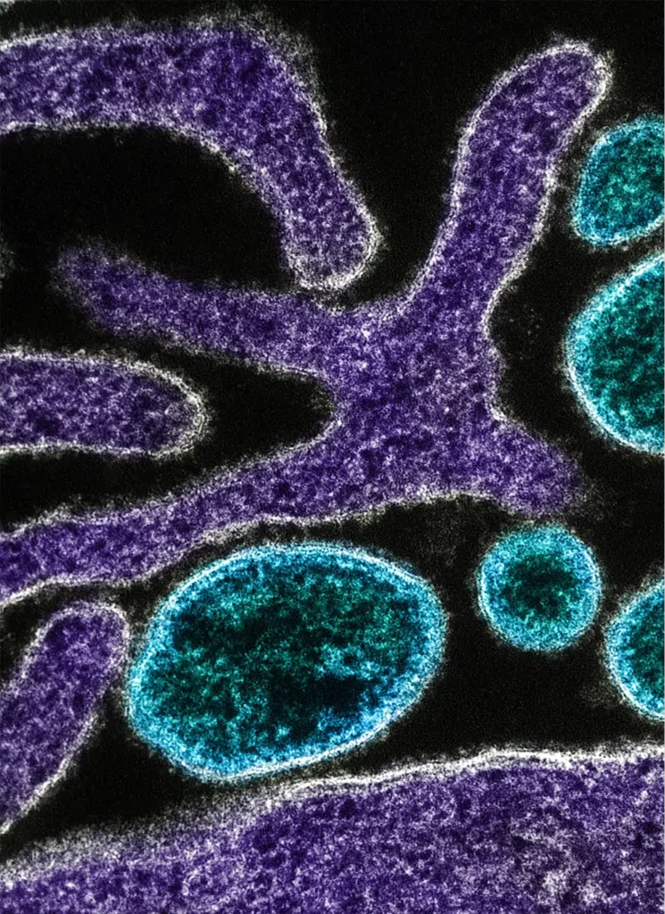 Virus Image: Colorized electron micrograph of Nipah Virus particles (blue) near the periphery of an infected Vero cell (purple).