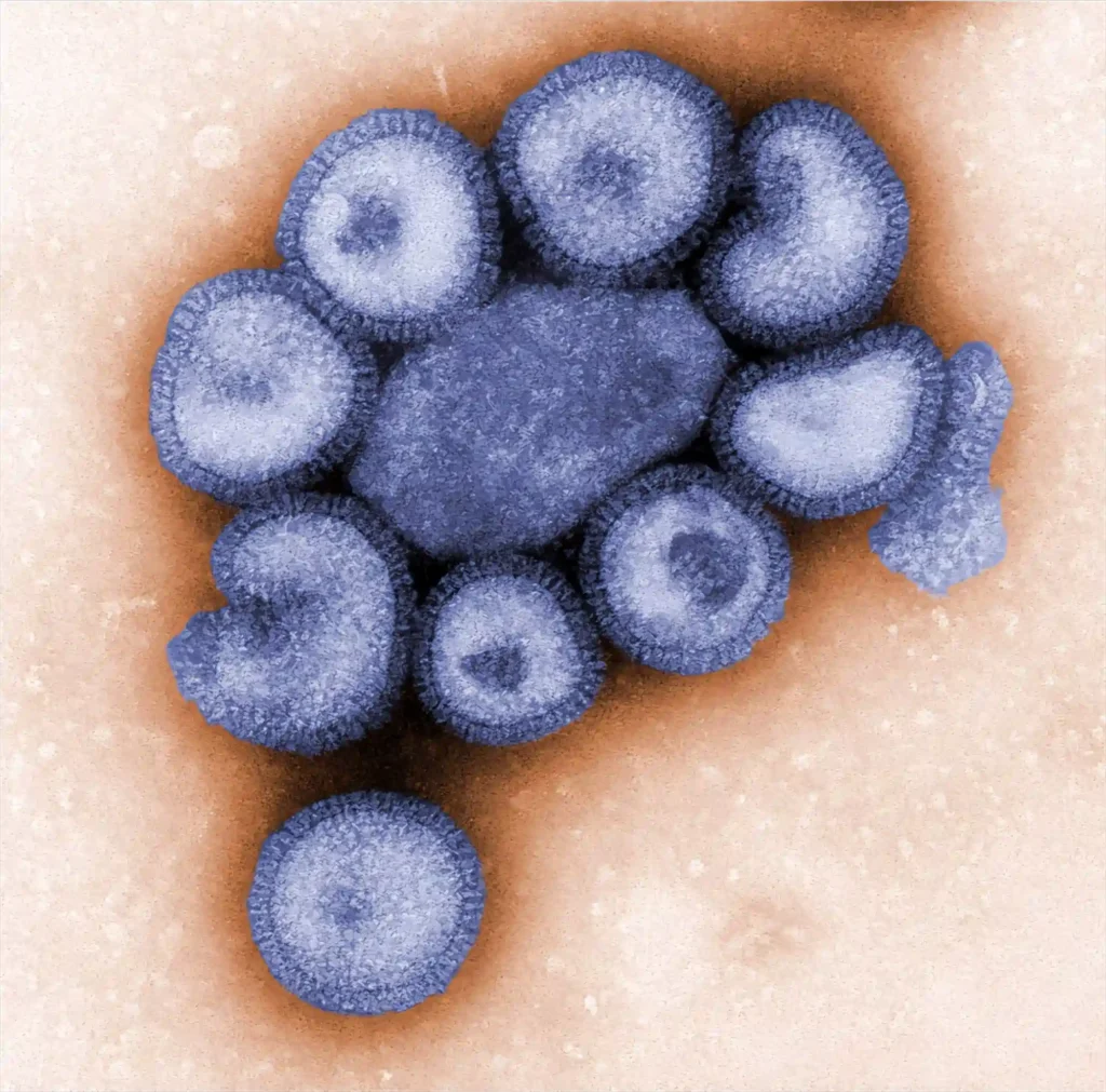 Virus Image: Colorized electron microscopic image of Influenza virus particles.