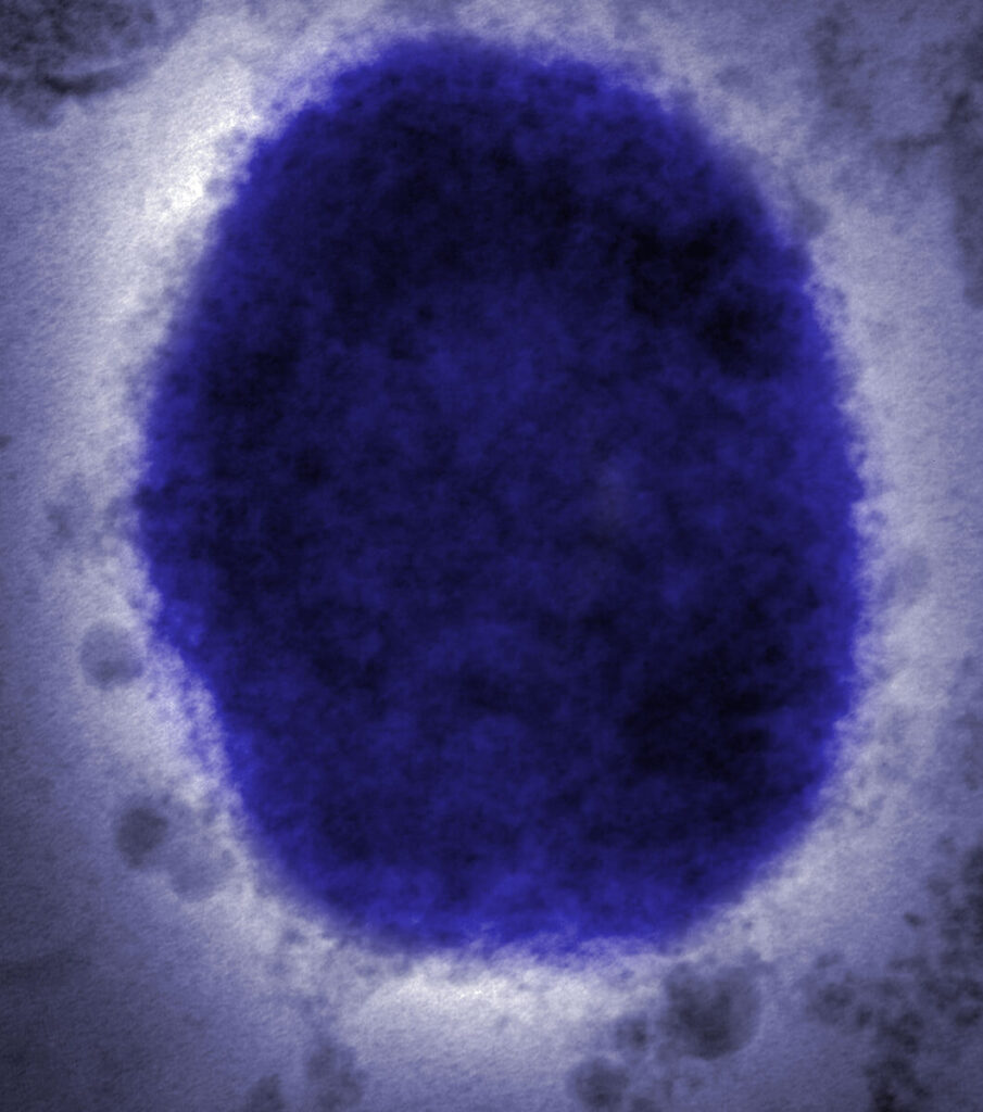 Microscopic view of monkeypox virus.