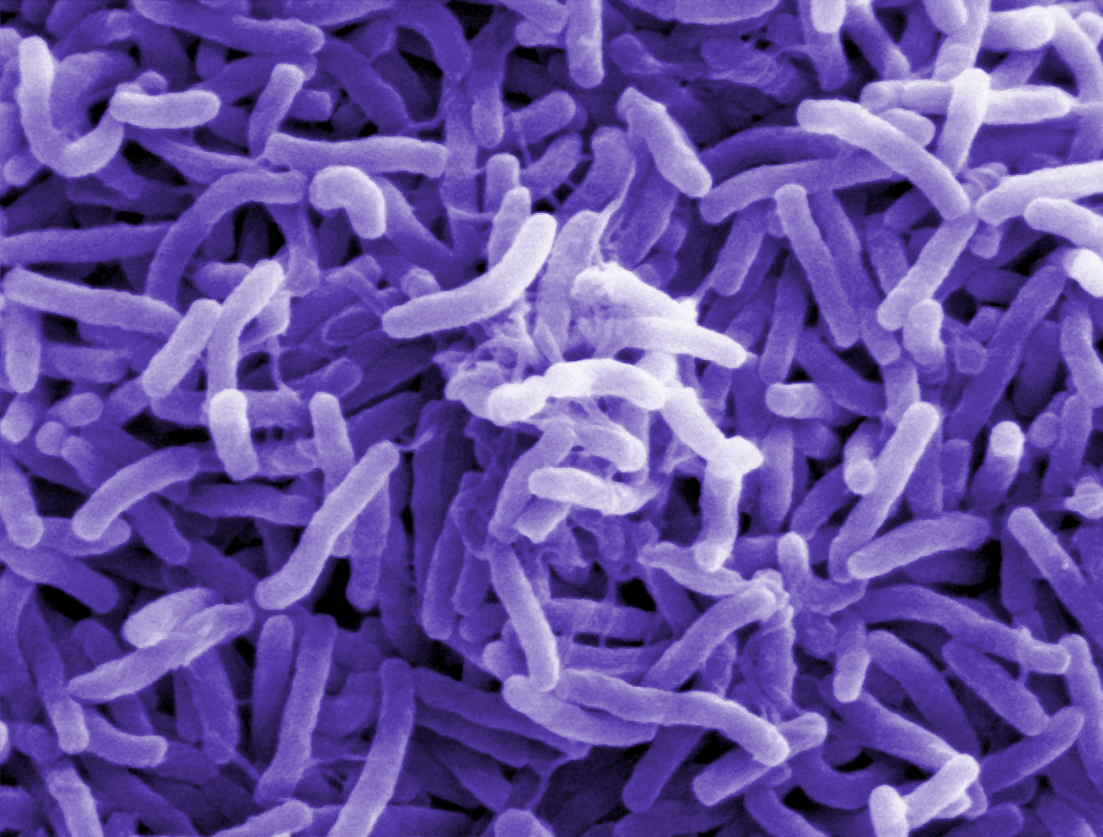 Virus Image: Electron microscope image of Vibrio cholerae bacteria, which causes cholera.
