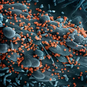 Scanning electron micrograph of Lassa virus budding off a cell