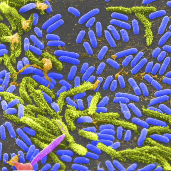 A colour enhanced electron microscope image of rod shaped cholera bacteria, coloured blue